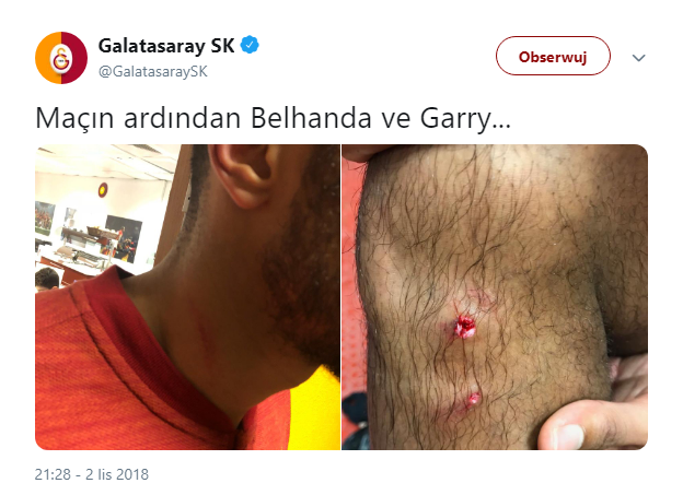 RANY piłkarzy Galatasaray po derbach z Fenerbahce